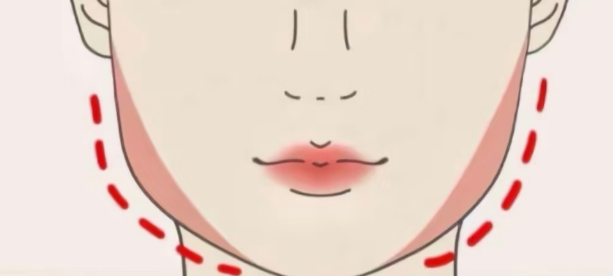 韓國咬肌肥大改善對比