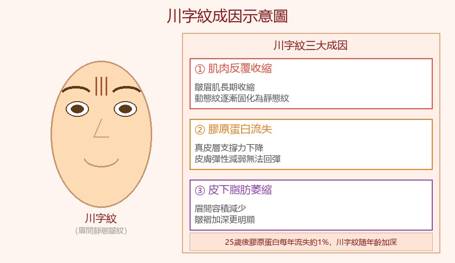川字紋成因示意圖|肌肉收縮膠原蛋白流失皺紋形成原理