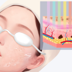 韓國皮膚科這樣選！內行人的挑選心法與預約技巧，一次全部告訴你