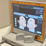 韓國ONDA是什麼項目？5大關鍵一次搞懂，無痛告別鬆垮肉！