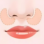 擺脫顯老囊袋！韓國口角囊袋解決全攻略，重塑微笑青春力