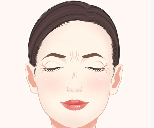 超聲炮多年操作後臉部馒化的原因分析