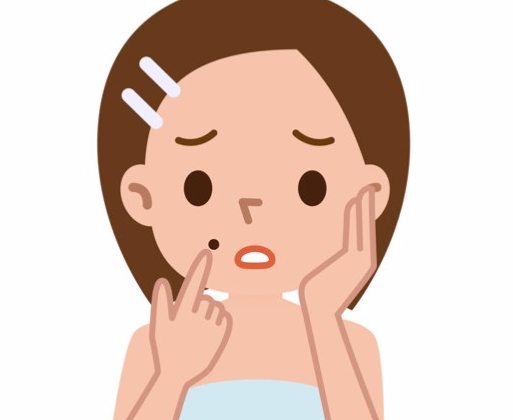 皮膚科痣的診斷與評估