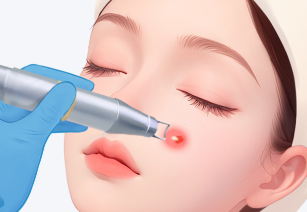 祛痣術後護理注意事項