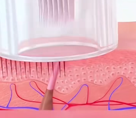 Photorejuvenation Treatments in South Korea’s Dermatology Departments