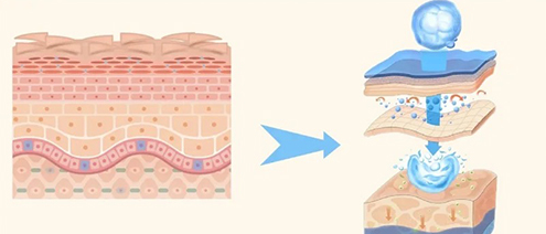 Hyaluronic Acid Injection Treatments at Dermatology Departments in South Korea