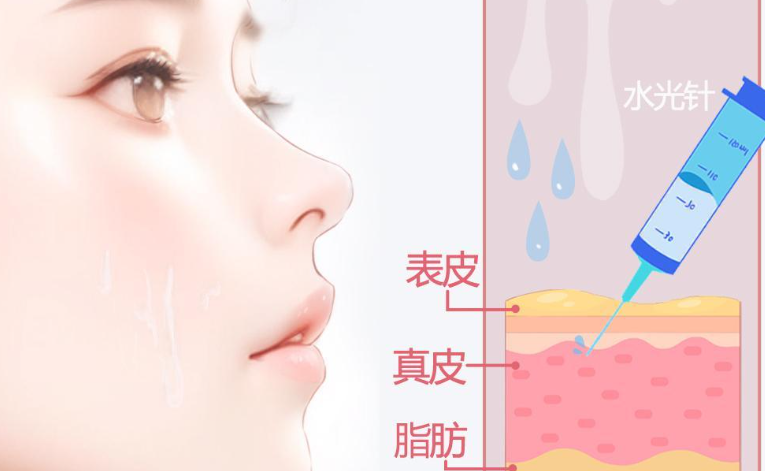 Book a Hyaluronic Acid Treatment at BeautsGO