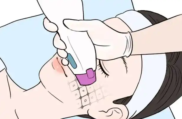 熱瑪吉適合人群與禁忌人群說明圖