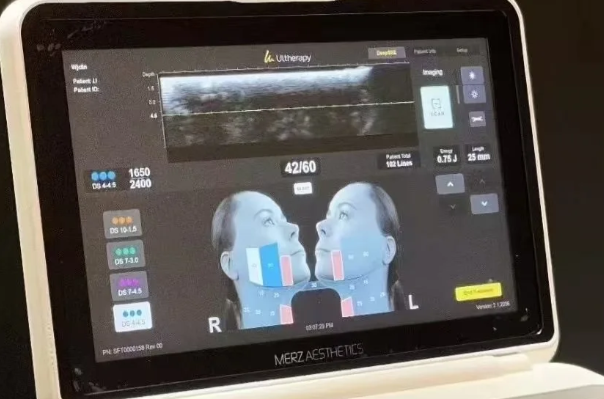 Comparison of the effects before and after HIFU treatment