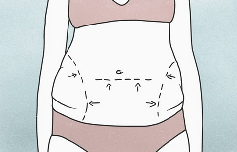 脂雕和抽脂有什麼區別?搞懂這兩種手術,才知道自己適合哪一種