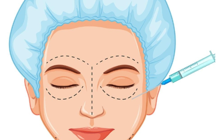 Juvelook黑瓶填充維持多久?叠加3次後,那種飽滿度能穩穩維持6-12個月+插图4 Juvelook黑瓶填充維持多久?叠加3次後,那種飽滿度能穩穩維持6-12個月+插图4