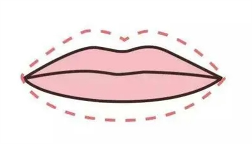 Berapakah kos untuk melakukan prosedur pembesaran bibir di Pulau Jeju? Analisis terperinci mengenai harga prosedur pengisian bibir dengan hyaluronic acid pada tahun 2026, serta cadangan hospital dan klinik yang sesuai.插图4 Ilustrasi proses suntikan untuk mengembangkan bibir (Gambar hanya untuk tujuan ilustrasi)
