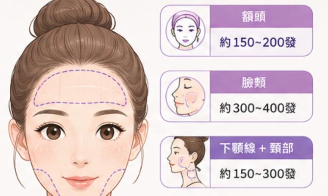 韓國熱瑪吉為什麼差價這麼大?一次看懂 FLX 版本、發數、真假探頭和醫院差別插图1 韓國熱瑪吉為什麼差價這麼大?一次看懂 FLX 版本、發數、真假探頭和醫院差別插图1